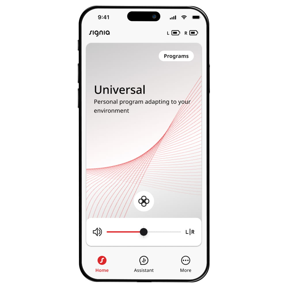 Signia App Remote control
