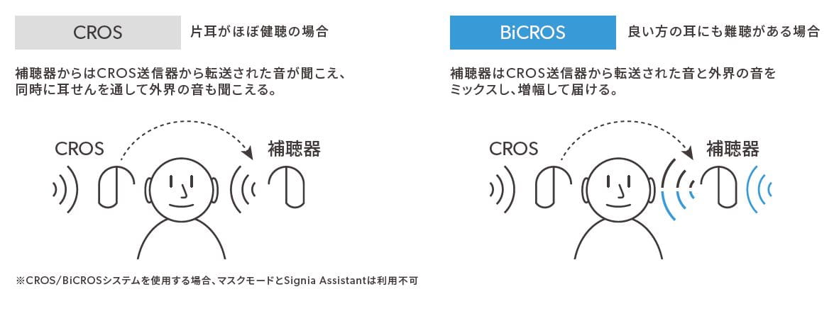 片耳難聴Q&A : 聞こえ方は、いろいろ 片耳難聴Q&A: 聞こえ方は、いろいろ | 岡野 由実 |本 | 通販