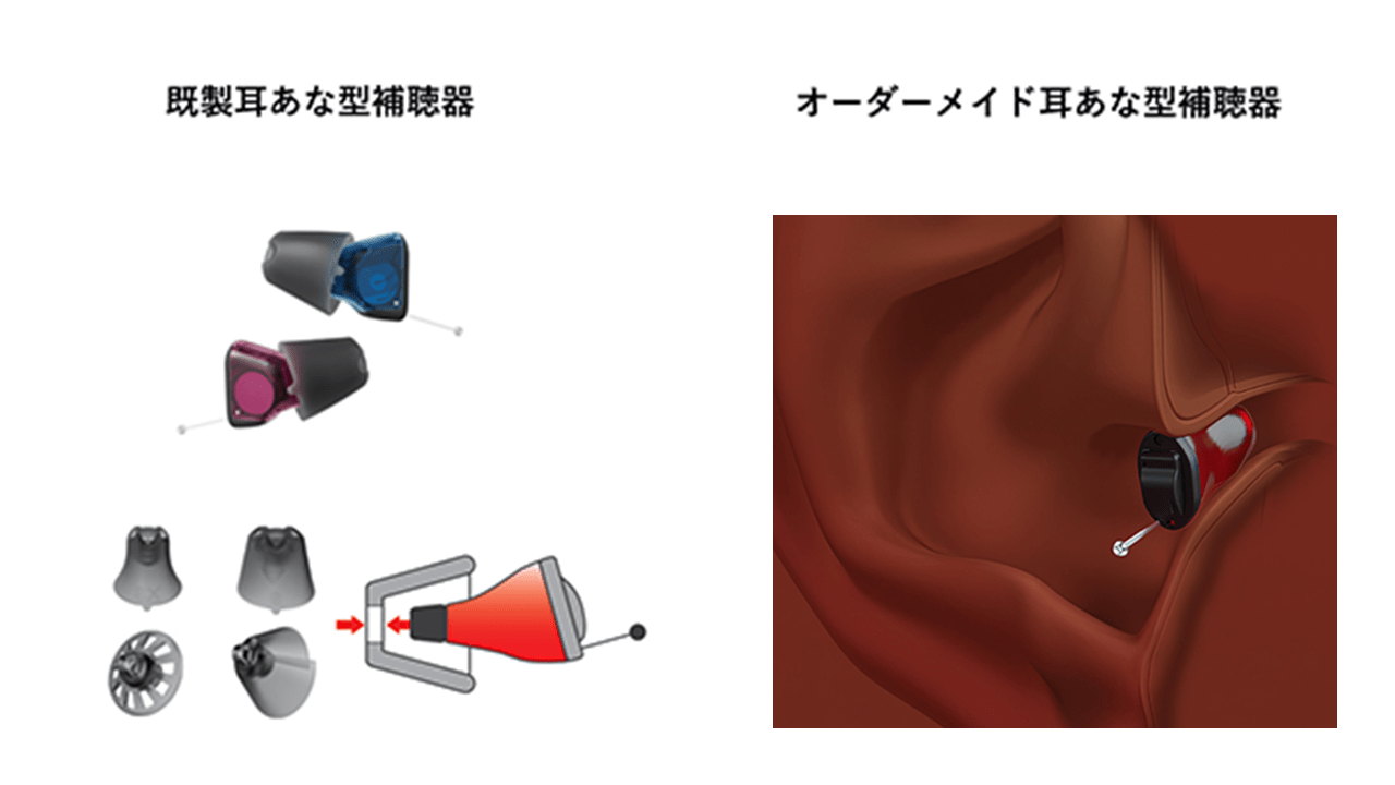 どう違う？？「既製耳あな型補聴器」と「オーダーメイド耳あな型補聴器